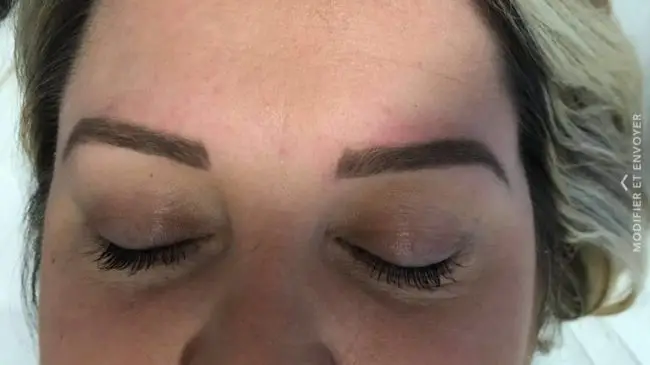 Dermopigmentation