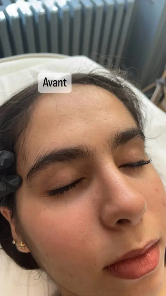 Avant-Après Restructuration des Sourcils à la pince à épiler